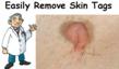 SkinTagsHelp.com, a Recently Launched Website from Internet Marketing...